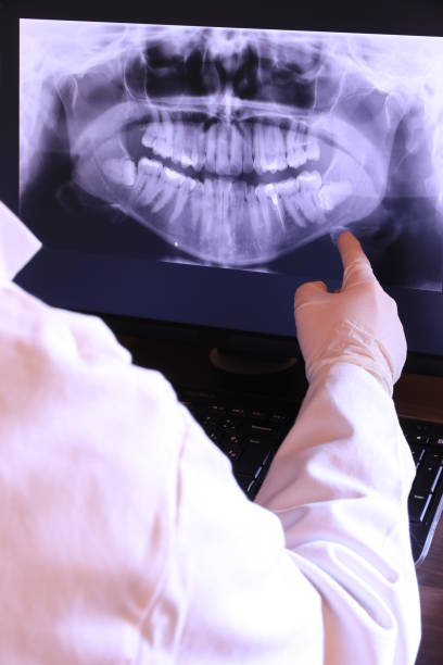 Best Emergency Treatment for Oral Infections in Lake City, SC