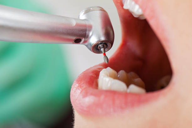 Best Emergency Treatment for Jaw Pain or Injury in Lake City, SC